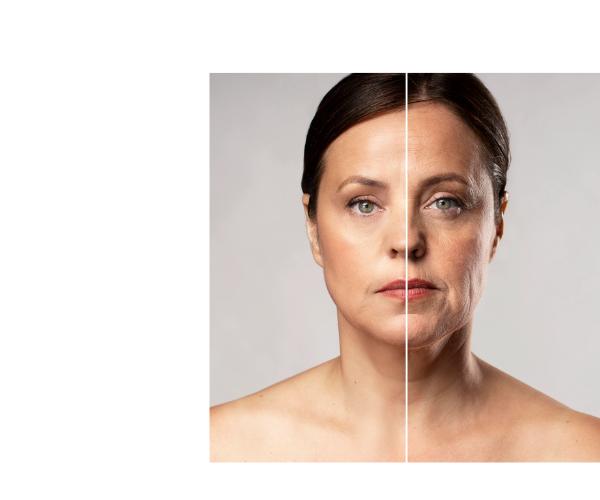 Die Wirkung von den Anti Aging Produkten wird durch ein Vergleichsbild gezeigt