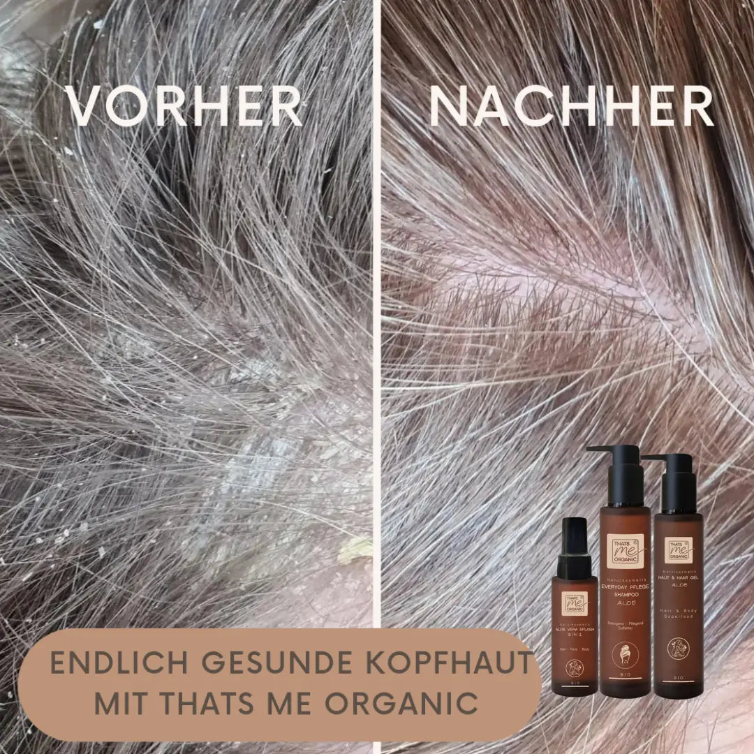 Splitbild der Kopfhaut vor und nach der Thats me organic®-Behandlung, das Bio Aloe Vera Splash und Nachfüllflasche 1000ml hervorhebt, mit deutschem Text, der diese Bio-Haarprodukte bewirbt.