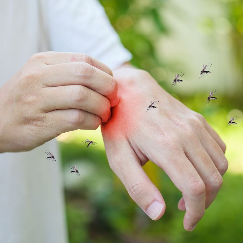 Eine Person kratzt sich an einer roten, gereizten Hand, während Mücken umherschwirren, was die Notwendigkeit eines natürlichen Mückenschutzes wie Thats me Organic® Hausmittel gegen Mücken zeigt.