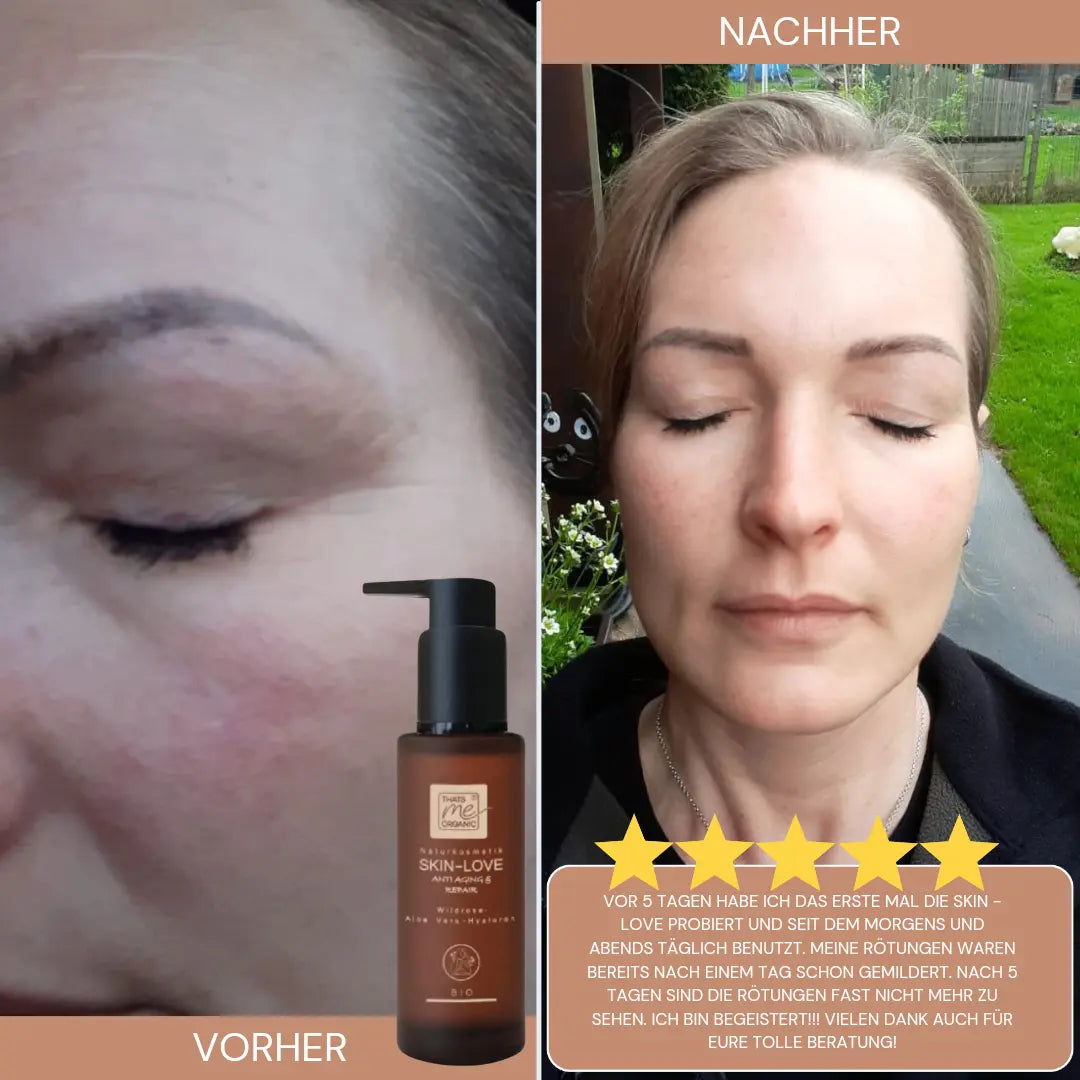 SKIN-LOVE – Wildrosen Gesichtsserum mit Aloe Vera & Hyaluron