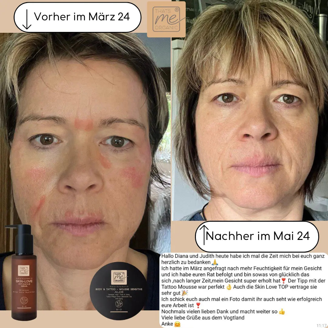 SKIN-LOVE – Wildrosen Gesichtsserum mit Aloe Vera & Hyaluron