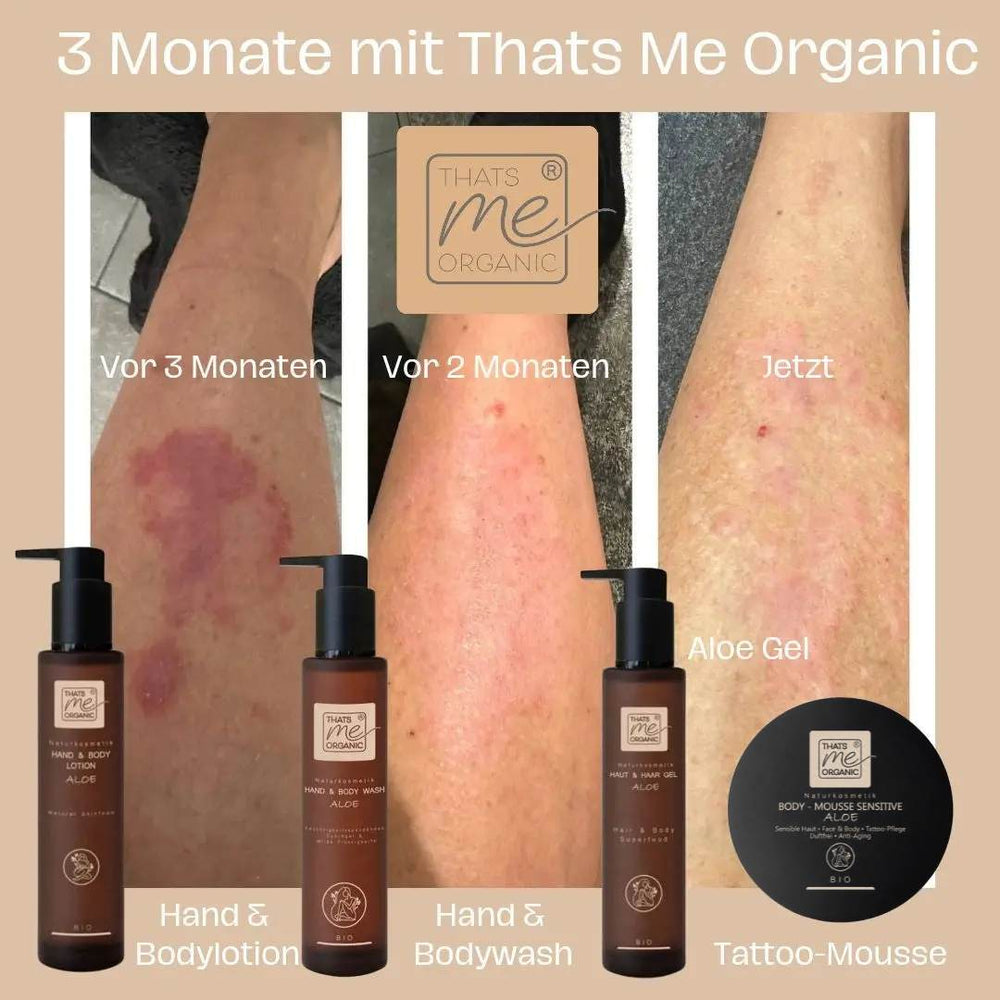 Erfolgsbilder nach drei Monaten Hautpflege mit Aloe Vera Naturkosmetik und BIO Body Tattoo Mousse Sensitive Aloe.
