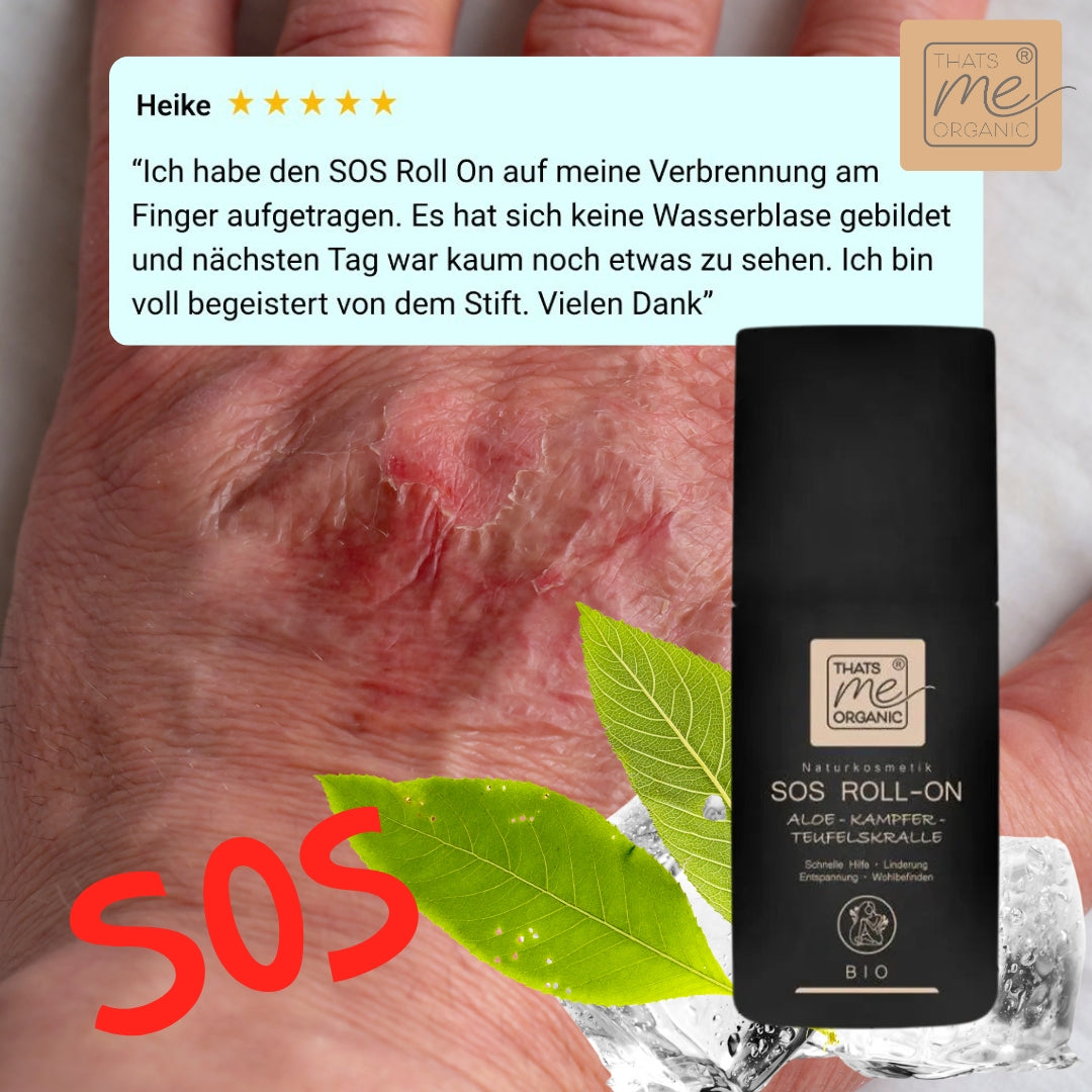 sos-roll-on-thats-me-organic-kundenbewertung-gegen-verbrennungen