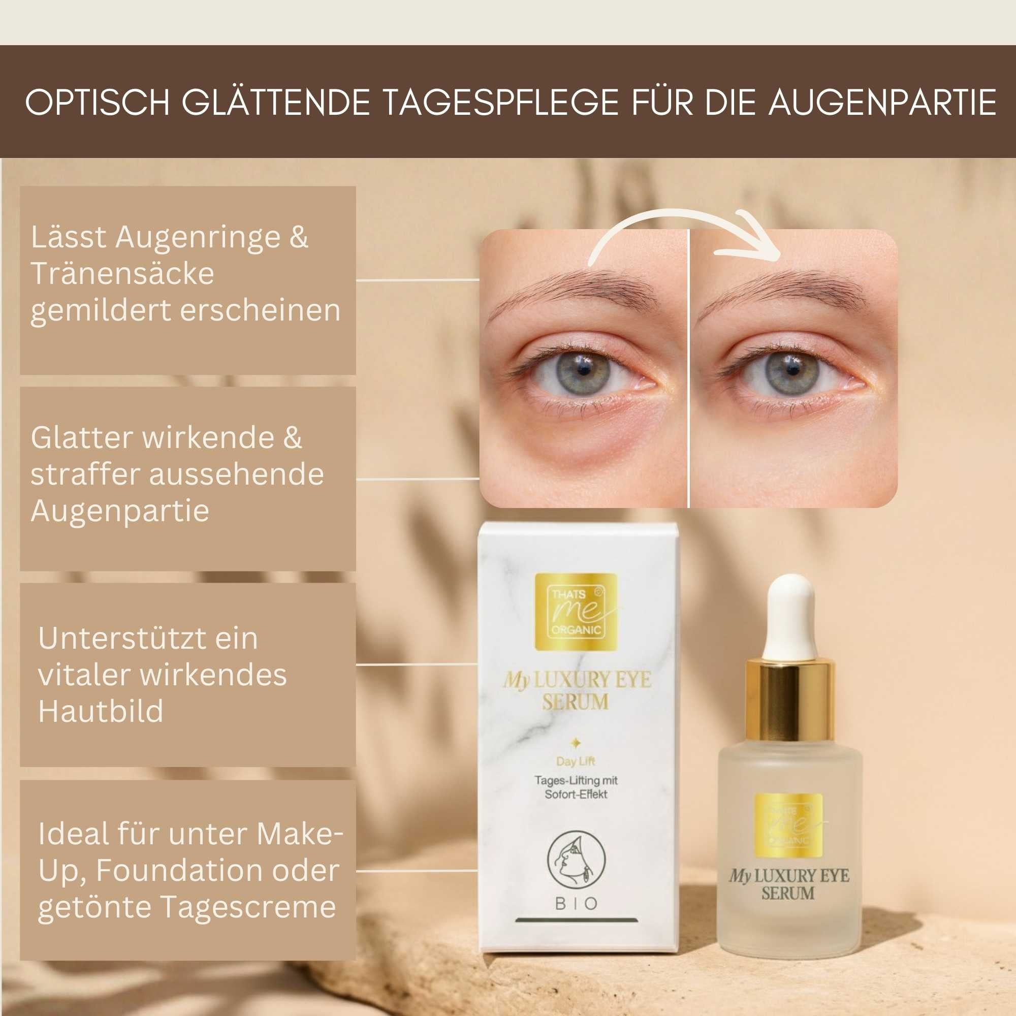 Vorher Nachher Vergleich Augenpartie mit My Luxury Eye Serum Day Lift