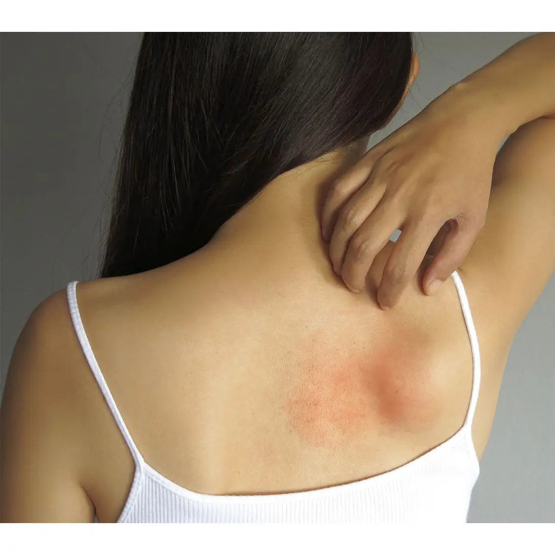 Pacchetto test allergico (10g colore su richiesta + cerotto compresso)