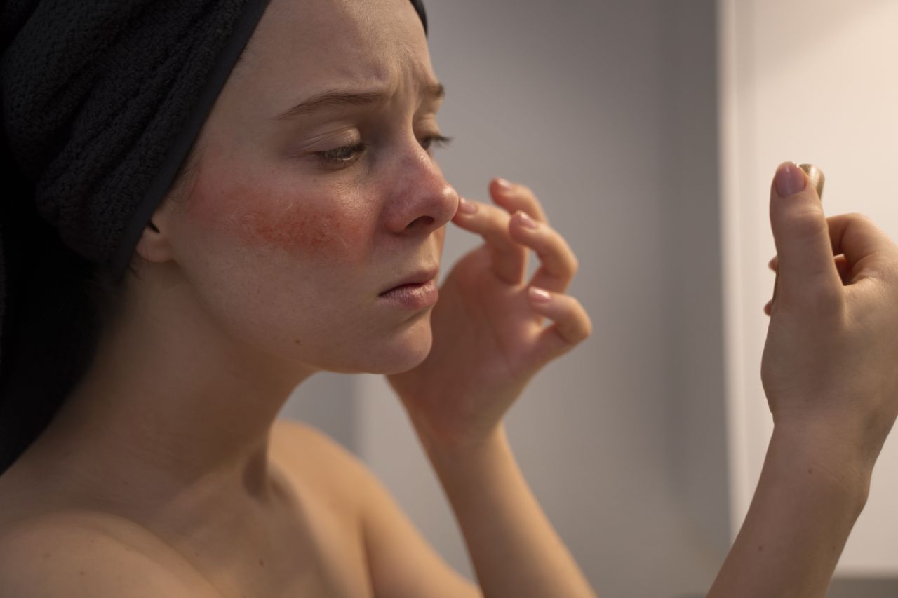 Rosacea: Ursachen, Symptome & sanfte Pflegeroutinen mit BIO Naturkosmetik