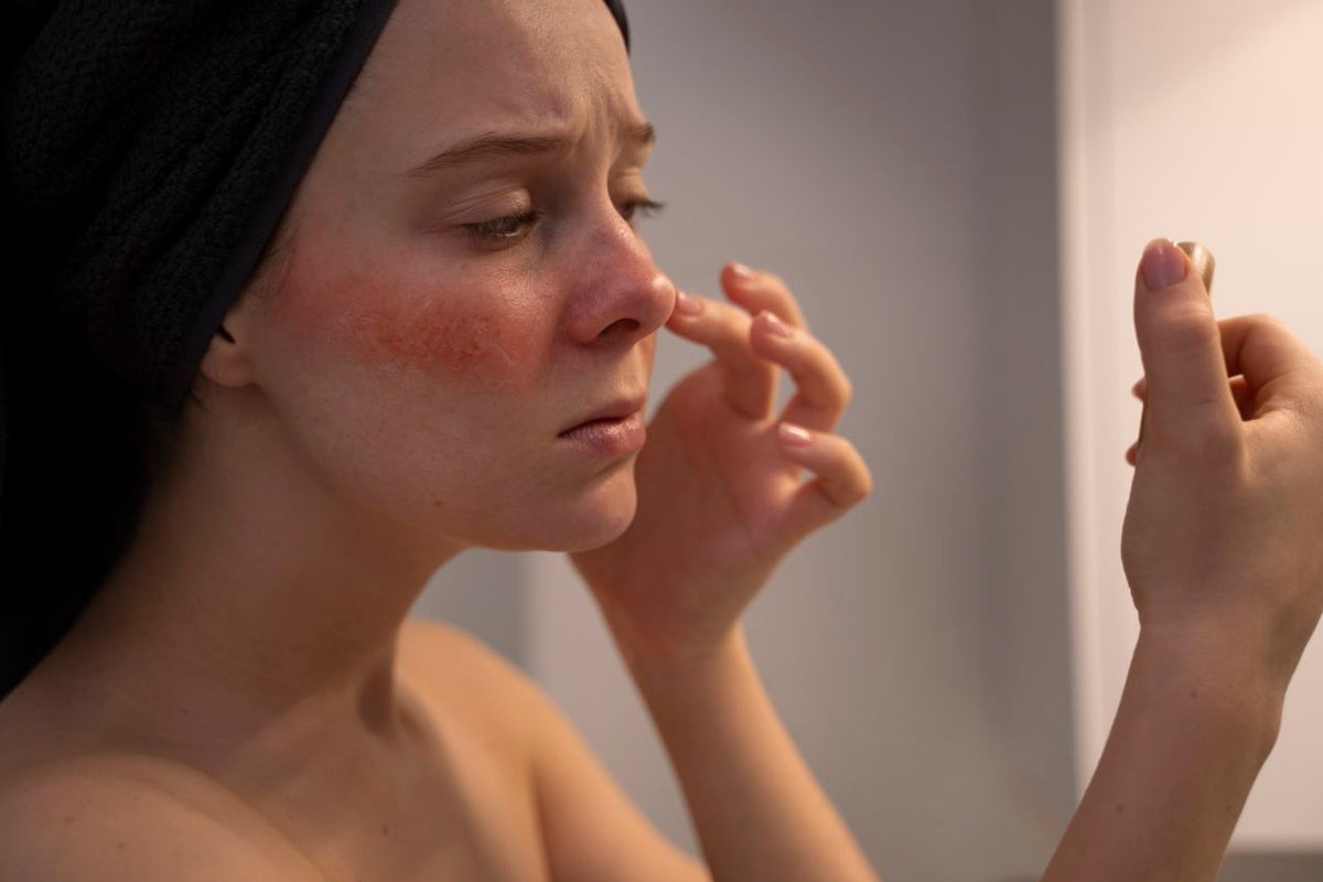Hautpflege bei Rosacea