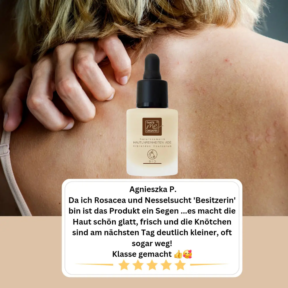 Detox Face Set – sanfte Gesichtspflege bei unreiner, empfindlicher Haut, Pickeln, Couperose & Rosazea