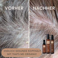 Splitbild der Kopfhaut vor und nach der Thats me organic®-Behandlung, das Bio Aloe Vera Splash und Nachfüllflasche 1000ml hervorhebt, mit deutschem Text, der diese Bio-Haarprodukte bewirbt.