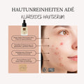 BIO-HAUTUNREINHEITEN ADÉ - Klärendes Hautserum mit Hyaluron 15ml Naturkosmetik
