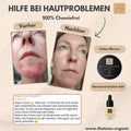 BIO-Body + Tattoo-Mousse sensitive Körperbutter Aloe mit Hyaluron 200ml Naturkosmetik