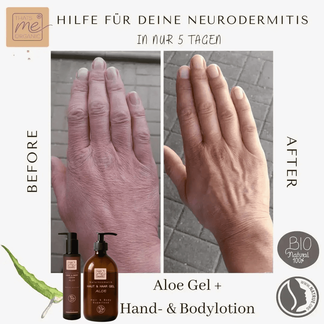 Vorher Nachher Anwendung vom Aloe Vera Gel bei trockener und gereizter Haut – feuchtigkeitsspendende Pflege mit Bio Aloe Vera