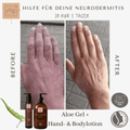 Vorher Nachher Anwendung vom Aloe Vera Gel bei trockener und gereizter Haut – feuchtigkeitsspendende Pflege mit Bio Aloe Vera