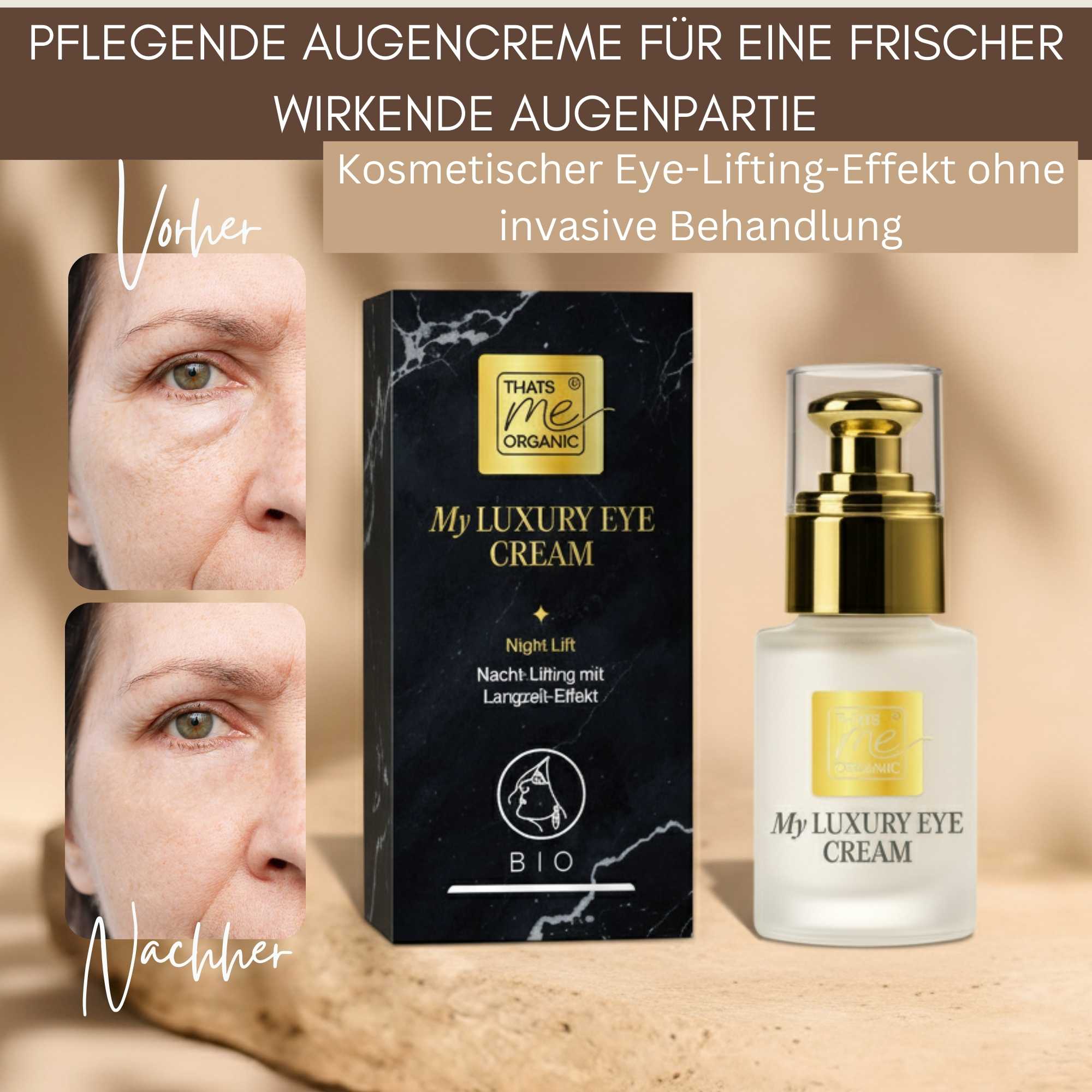 Vorher-Nachher-Darstellung der Augenpartie mit My Luxury Eye Cream Night Lift – gepflegt wirkende Haut über Nacht, rein kosmetische Darstellung.