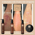 Erfolgsbilder nach drei Monaten Hautpflege mit Aloe Vera Naturkosmetik und BIO Body Tattoo Mousse Sensitive Aloe.