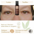 BIO-Hyaluron-Gesichtsserum Aloe - Anti Aging - glättend + straffend 30ml vegan